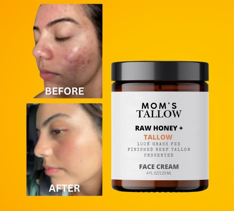 Mom's Tallow 100% Grass Fed Beef Tallow for Skin Care with Raw Honey | Face +... gallery