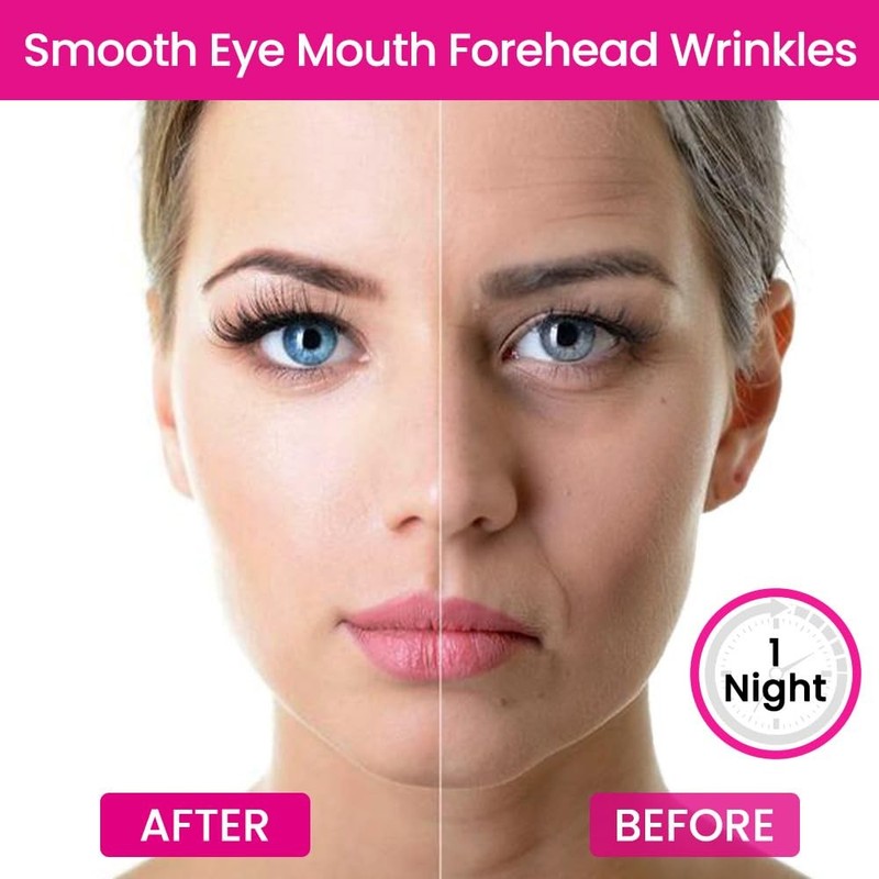 evpct 192Pcs Face Facial Medical Wrinkle Tapes Wrinkle Patches for Wrinkles gallery