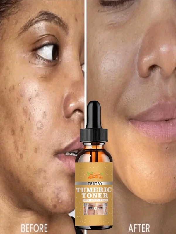 Brightening Serum To Improve Dullness Fade Spot Marks Lift Tighten Skin With…