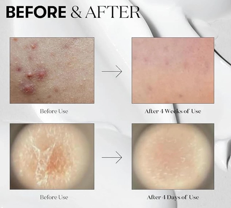 VT COSMETICS CICA Reedle Shot 100, Spicule Microneedling Serum 05/28 gallery