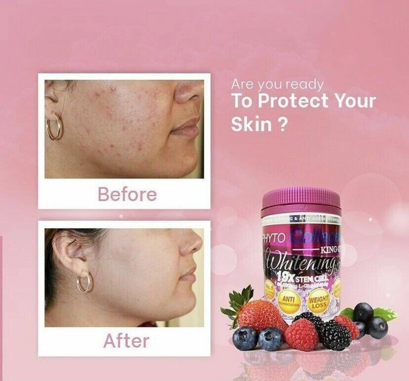 3x Phyto Collagen King of Whitening Anti-Aging 19x Stemcell Latest Stocks By DSM gallery
