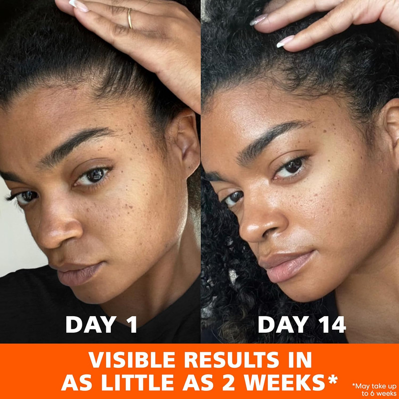 Skin Success Anti-Dark Spot Fade Cream with Vitamin E and Niacinamide, for All S gallery