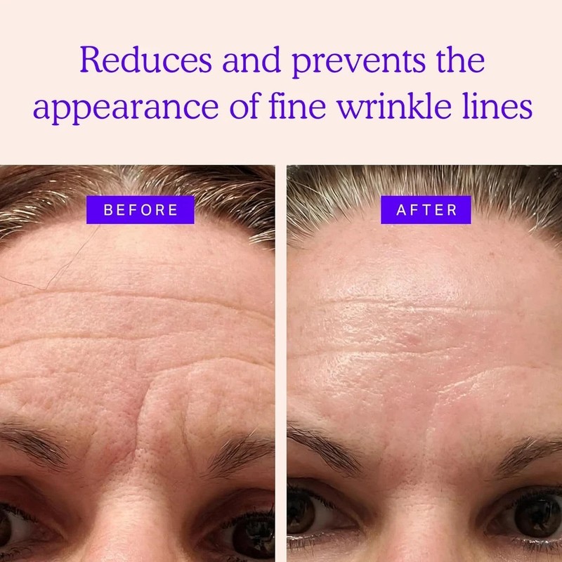 BLUMBODY Face & Forehead Wrinkle Patches - anti Wrinkle Facial Patches to Smooth gallery