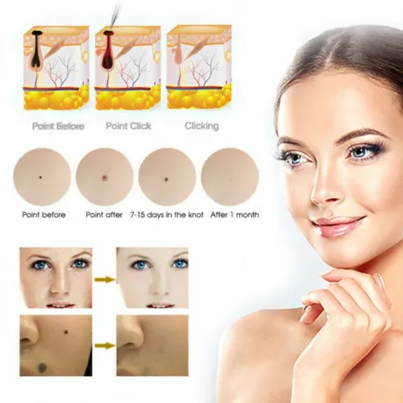 9 Level Electric Laser Plasma Pen Handheld Tattoo Skin Removal Salon Beauty Tool gallery