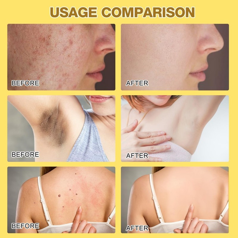 2026 Professional Bee Venom Treatment Cream - Moisturizing Skin Repair (2 Jars) gallery
