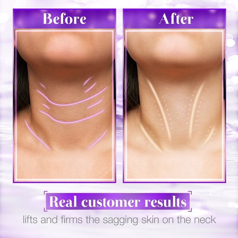 👻 Treat Your Skin! 30% OFF Aavini Neck Cream – Firm, Brighten & Tighten Fast gallery