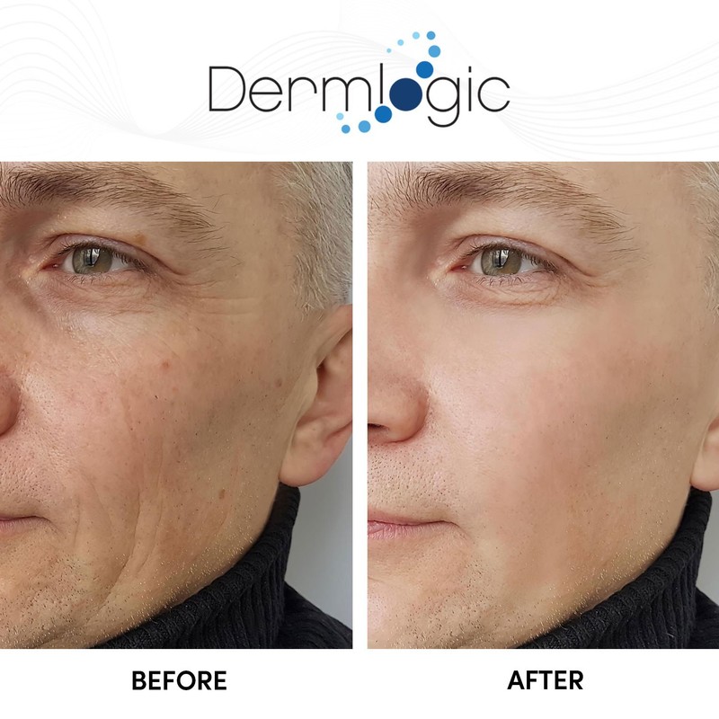 Glycolic Cream 15% - Anti Aging Exfoliator to Smooth Away Fine Lines & Wrinkle. gallery