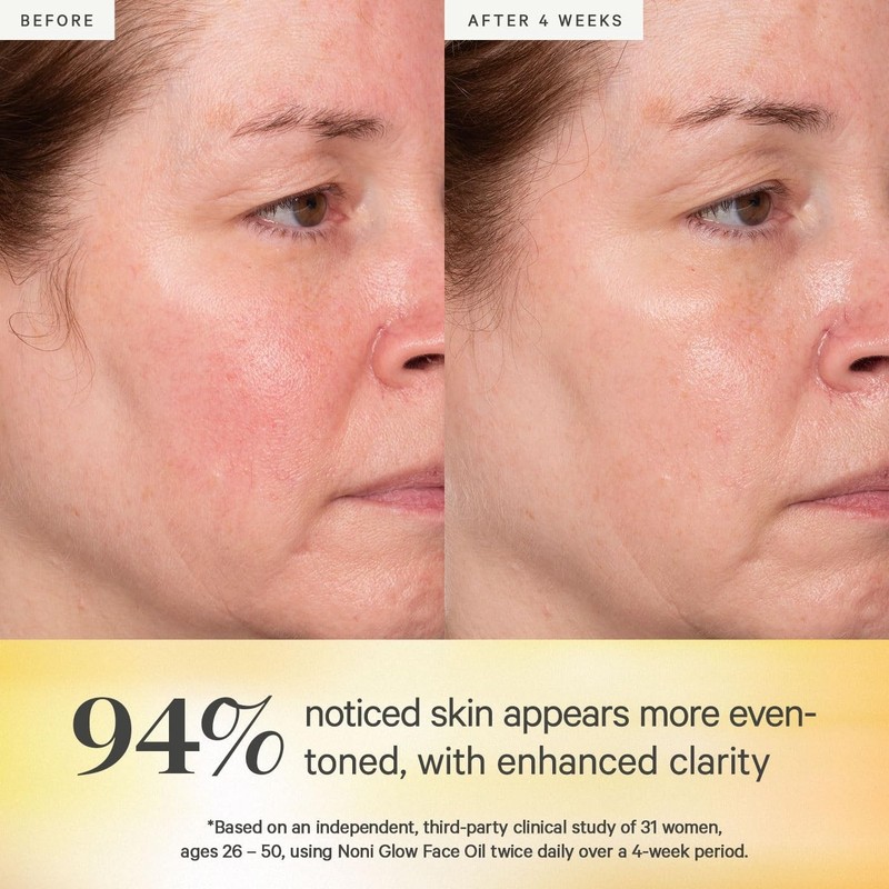 Lightweight Facial Oil for Radiant Skin - Rosehip & Jojoba^- gallery