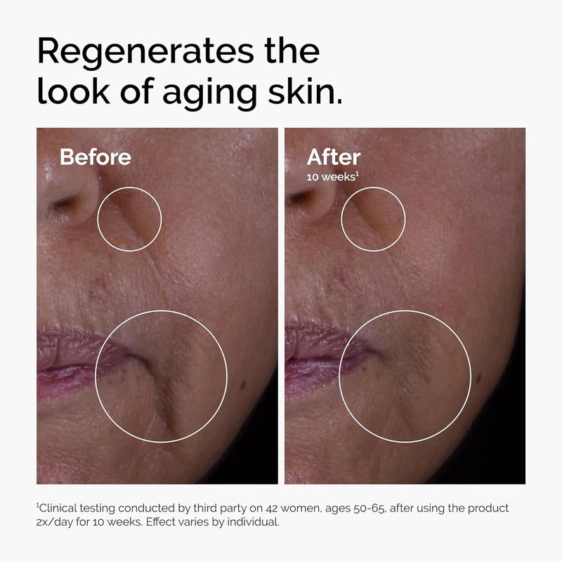 Transformative 15% Solution: Anti-Aging & Wrinkle Repair for Face and Neck gallery