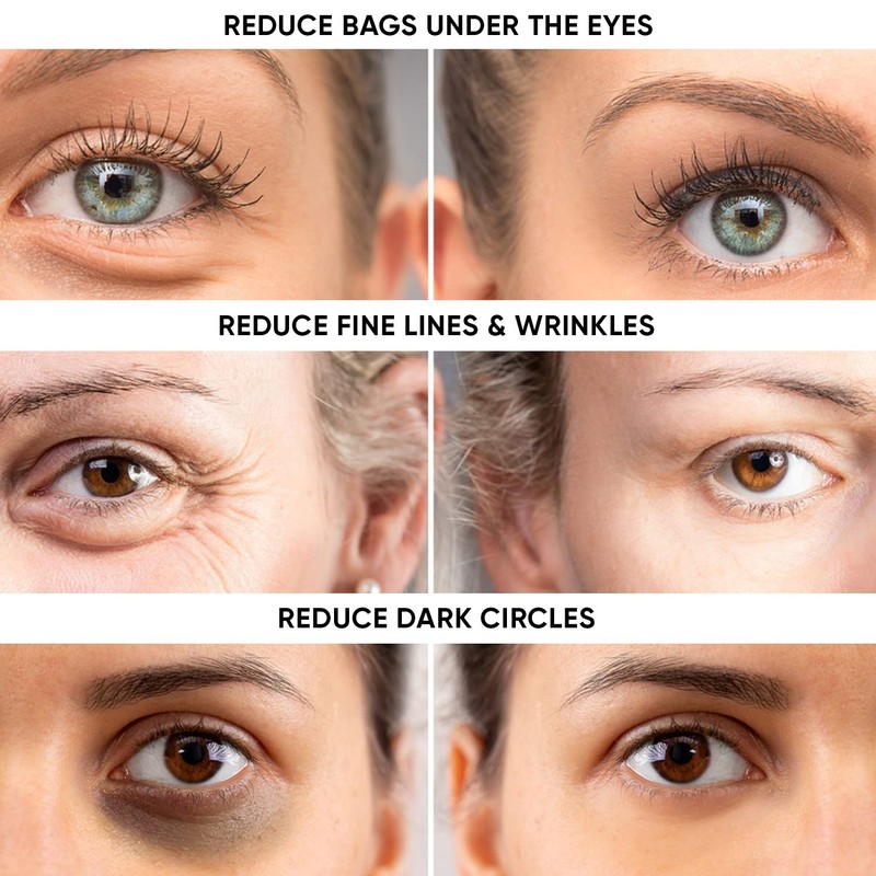 Instant Puffy Eye & Lift Treatment – Removes Under Eye Bags & Puffiness. gallery