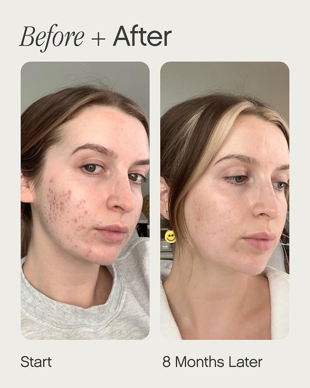 Faded Brightening & Clearing Serum 0.5 Fl Oz | Reduces Skin Discoloration Fast gallery