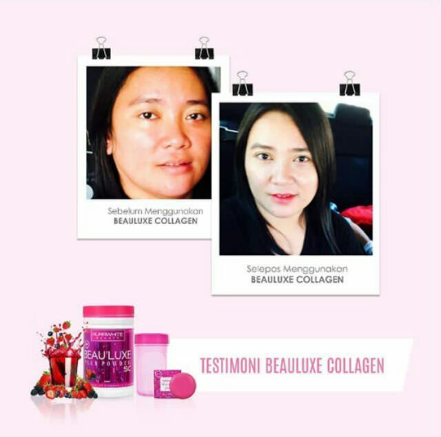 Aura White BEAULUXE SC+ Collagen Stemcell 15X L-Glutathione Whitening DHL EXPRES gallery