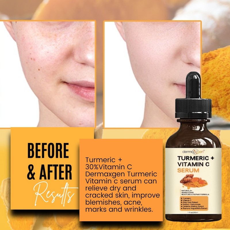 Dermaxgen® TURMERIC FACE SERUM + VITAMIN C + HA + ALOE – PIGMENTATION CORRECTOR