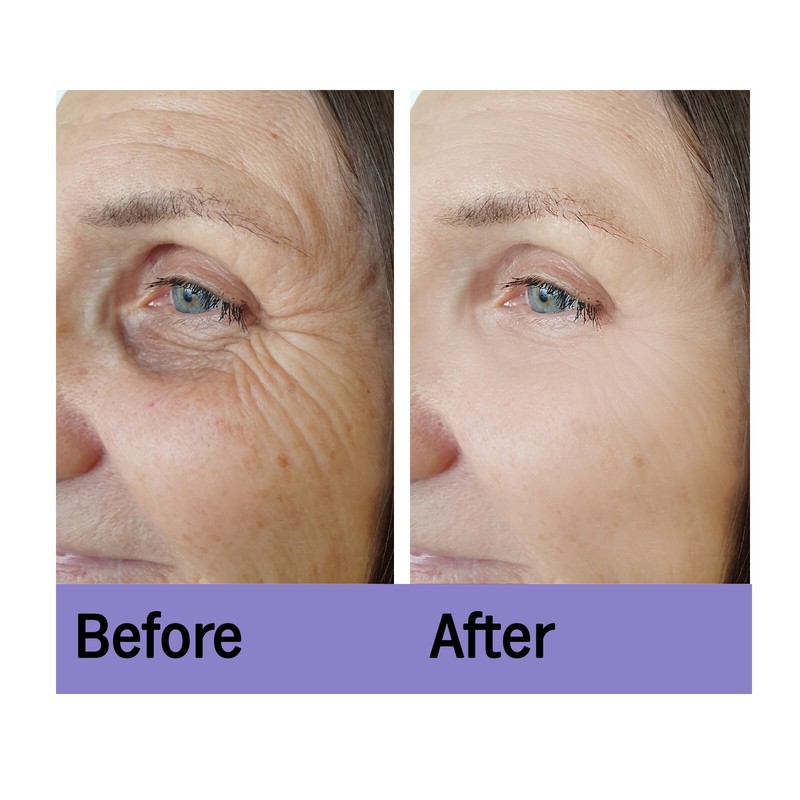 Skincyclopedia Facial Treatment, Polyglutamic & Peptide, Skin Texture Repair gallery