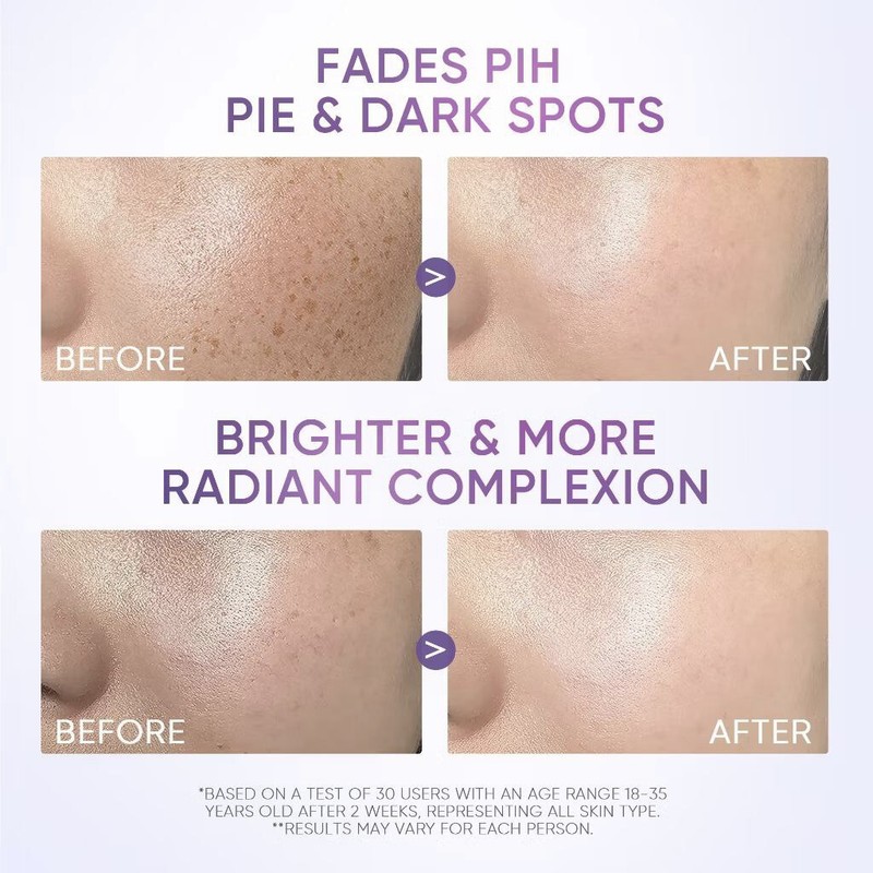 SKINTIFIC Dark Spot Moisture Gel SYMWHITE 377 Brightening Acne Scar Aging Skin gallery