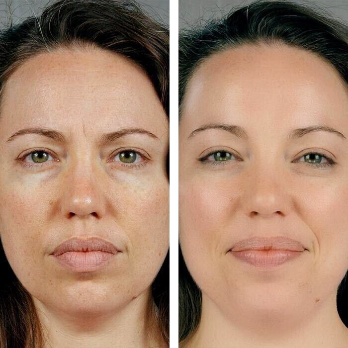 2027 Elizabeth Arden Retinol + HPR Ceramide Rapid Skin-Renewing Water Cream 50ml gallery