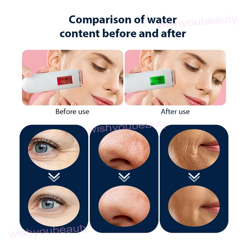 7 Colors CO2 Oxygen Bubble Machine Facial Skin Care Exfoliating Beauty Device gallery