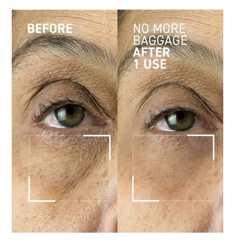 Dr. Brandt Needles No More, No More Baggage - Minimizes Under-Eye Bags gallery