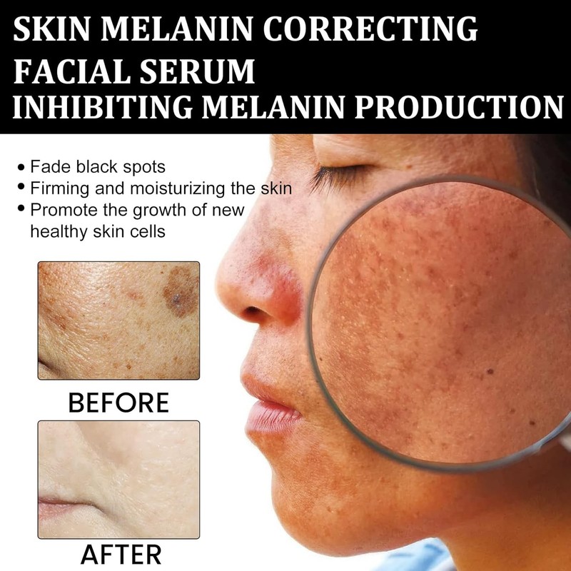 Melanin Correcting Facial Serum, Dark Spot Corrector Daily Face clear 3PC gallery