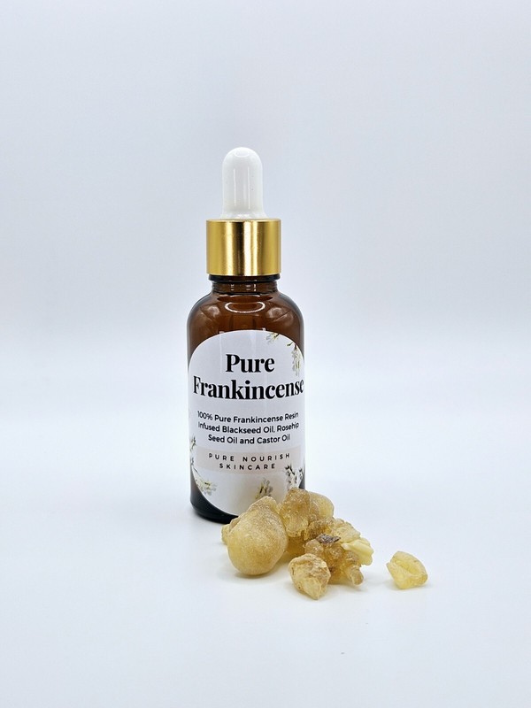 FRANKINCENSE INFUSION, BOSWELLIA CARTERI RESIN, BLACKSEED, CastorOil, ROSEHIP