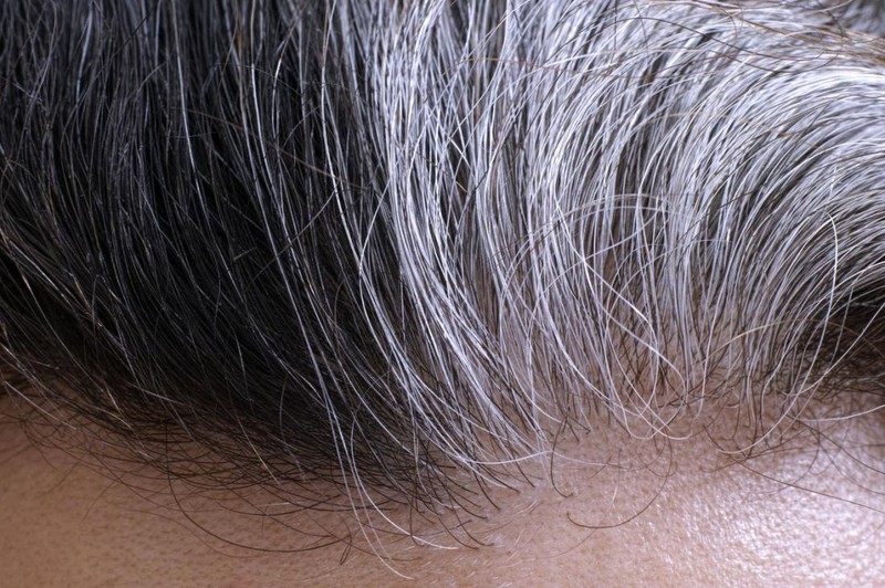 energy boost natural - GRAY HAIR - GREEN TEA COMBO 2B - nettle hair loss gallery