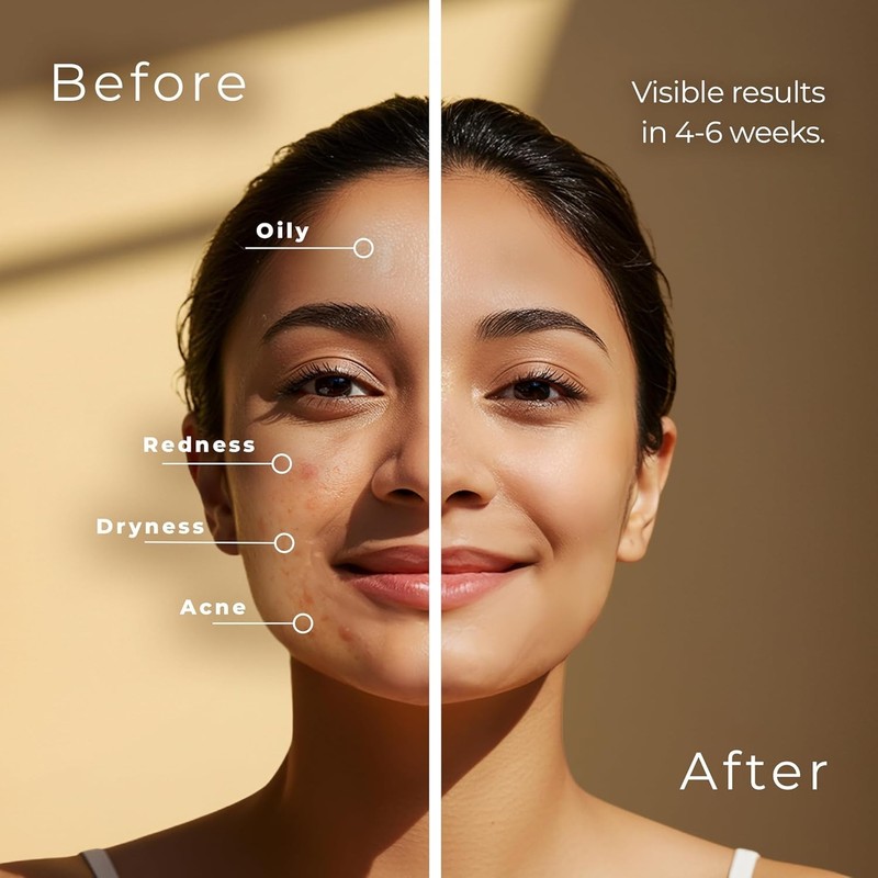 Turmeric Kojic Acid &Facial Exfoliating Peel Cleansing 55 Pads Dark Spot Remover gallery