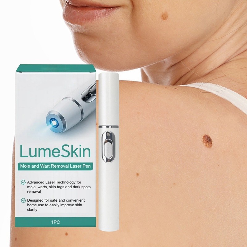 Electric Laser Plasma Pen Mole Removal Dark Spot Remover Skin Wart Tag Remover gallery