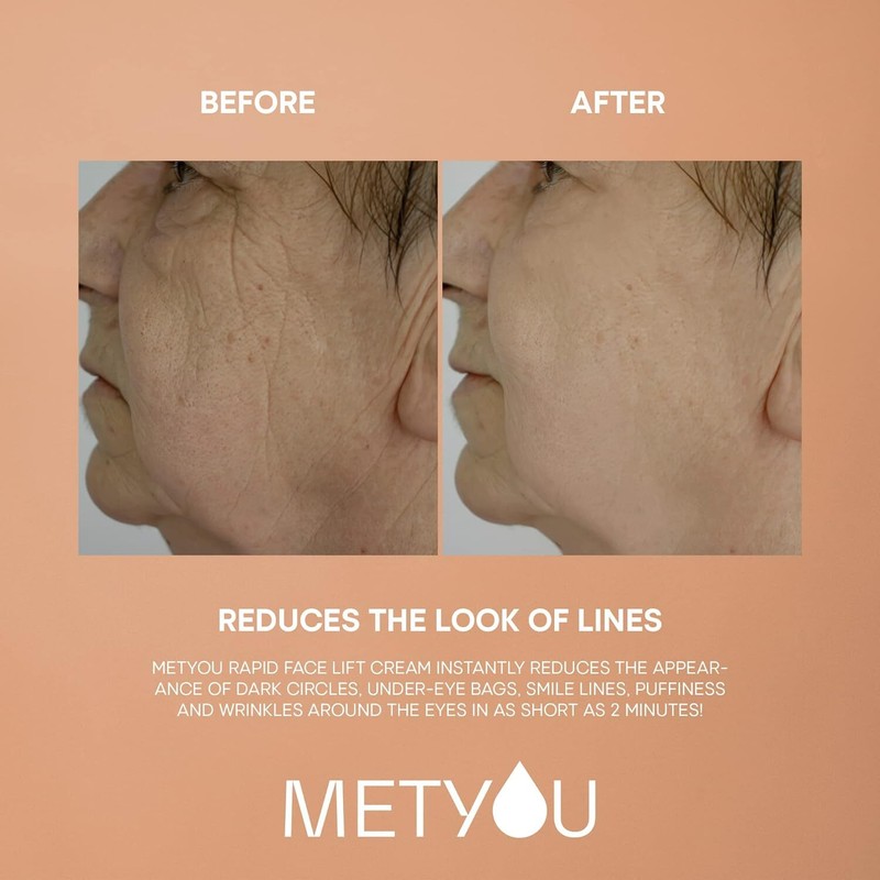 Instant Face Lift Face and Eye Tightening and Lifting Serum in 2 Minutes, 1 oz gallery