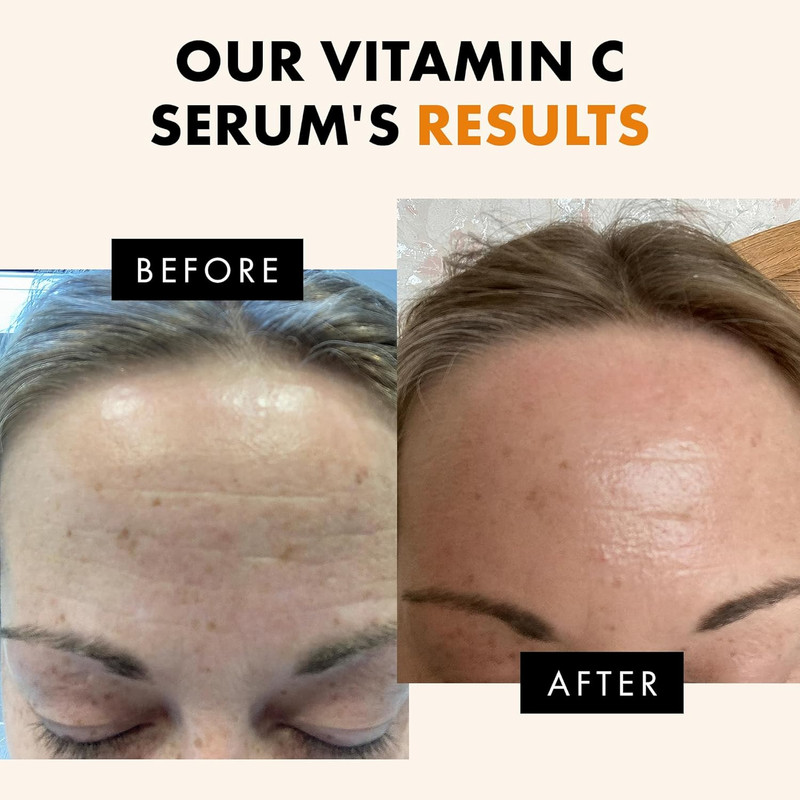 Eclat Skincare Vitamin C Serum - Skin Care for Dark Spots, Vitamin C Serum for F gallery
