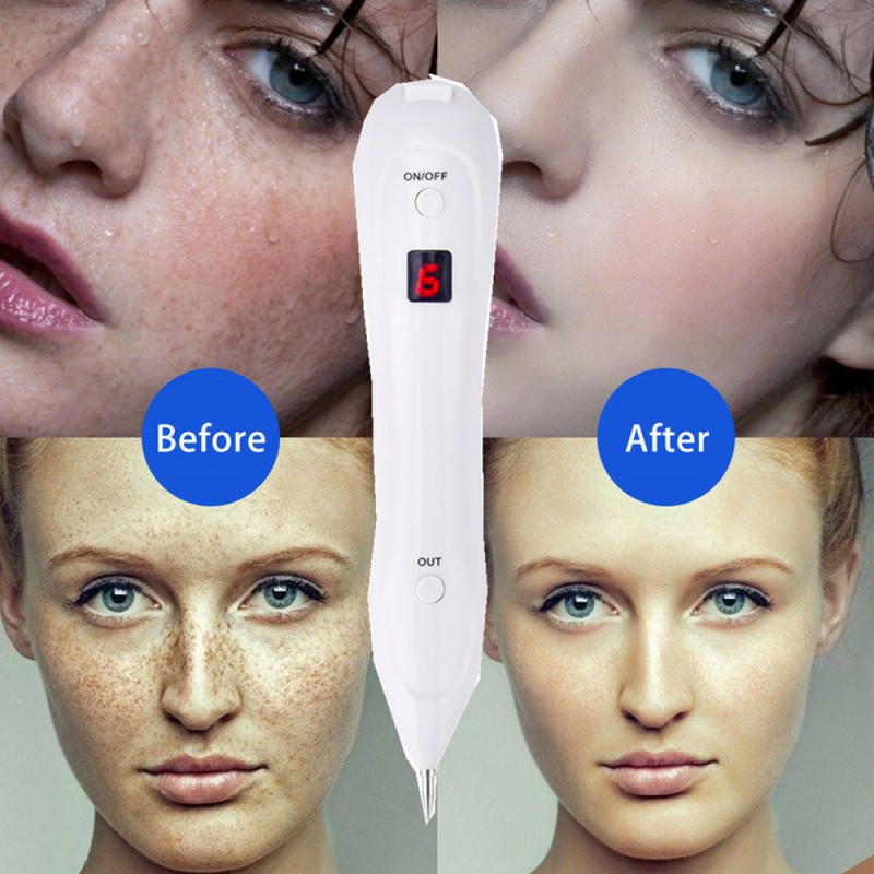 Laser Plasma Pen Dark Spots Skin Tags Tattoo Mole Wart Remover Pen Mole Removal gallery
