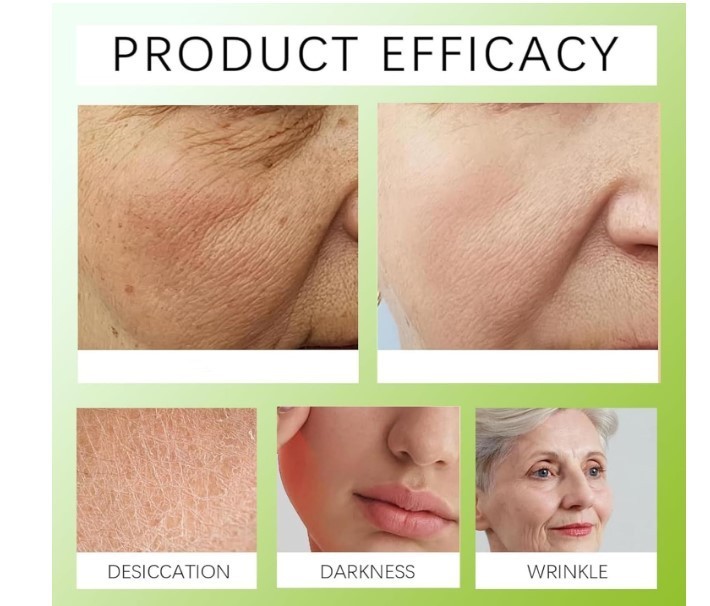 2PCS Retinol Tightening Cream with Vitamin A for Smooth Looking Skin gallery
