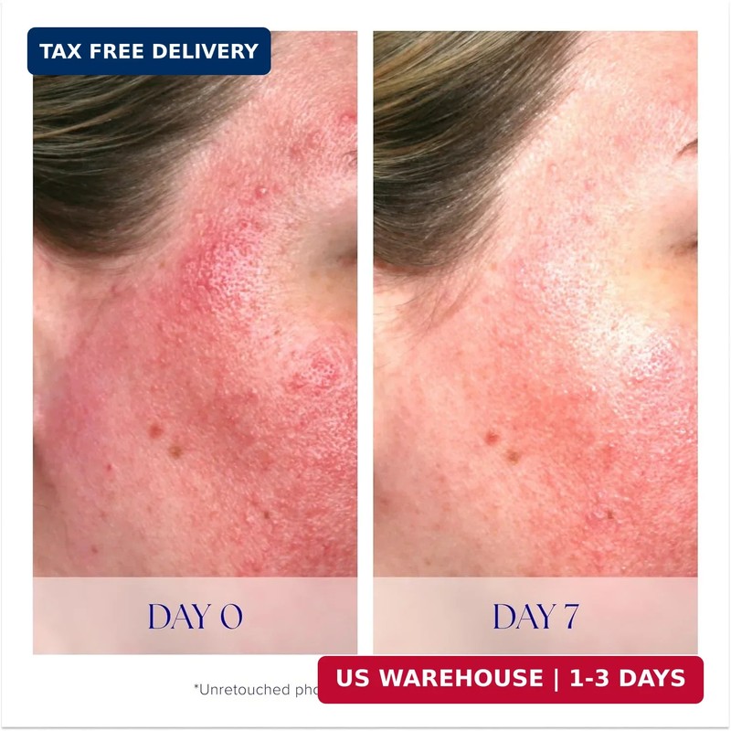 iS CLINICAL Pro-Heal Serum Advance+ - Antioxidant-Rich Vitamin C Serum, Calms Se gallery