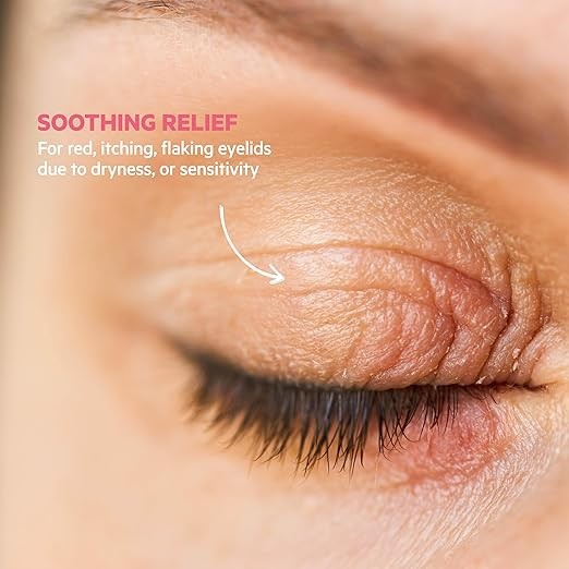 Topialyse Palpebral Anti Itching Soothing Cream Calms Irritated Eyelids 15mL gallery