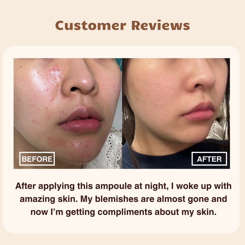 GD11 Premium Exosome Ampoule Set, Korean Stem Cell Serum for Glass Skin Glow gallery