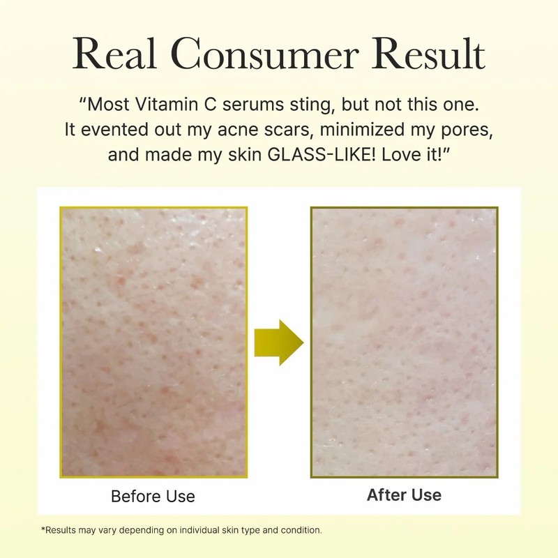 Arencia Vitamin C Booster Shot (30ml) Brightening Glow Booster gallery