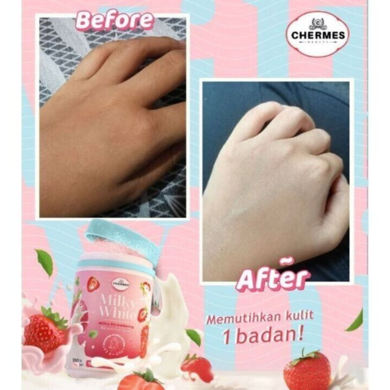 x4 K-Colly Chermes MilkyWhite Collagen 500g Strawberry Whitening Skin Supplement gallery