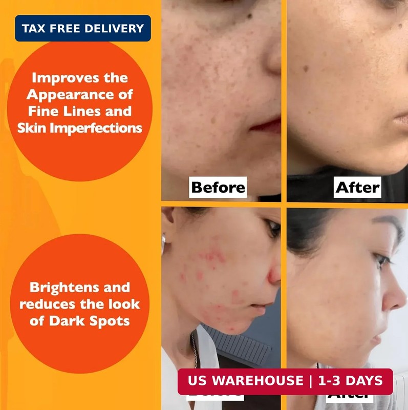2 Fl Oz Vitamin C Serum For Face-Anti Aging Face Serum with Vitamin C, Hyalu... gallery