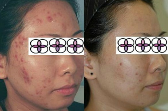 10% Glycolic Acid Night Cream 2oz Excellent for Acne/Aging/Sun Damaged Skin! gallery