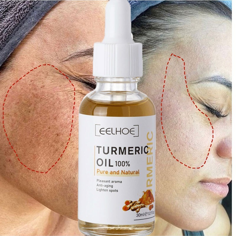 Turmeric Freckle Whitening Serum Curcumin Oil Face Brighten Fade Dark Spot Remov gallery