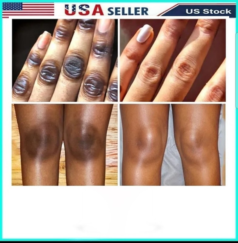 2X Kojic Albutin Milk Serum Face Body Dark Spot Brightening, 50ml/ea [USA Stock] gallery