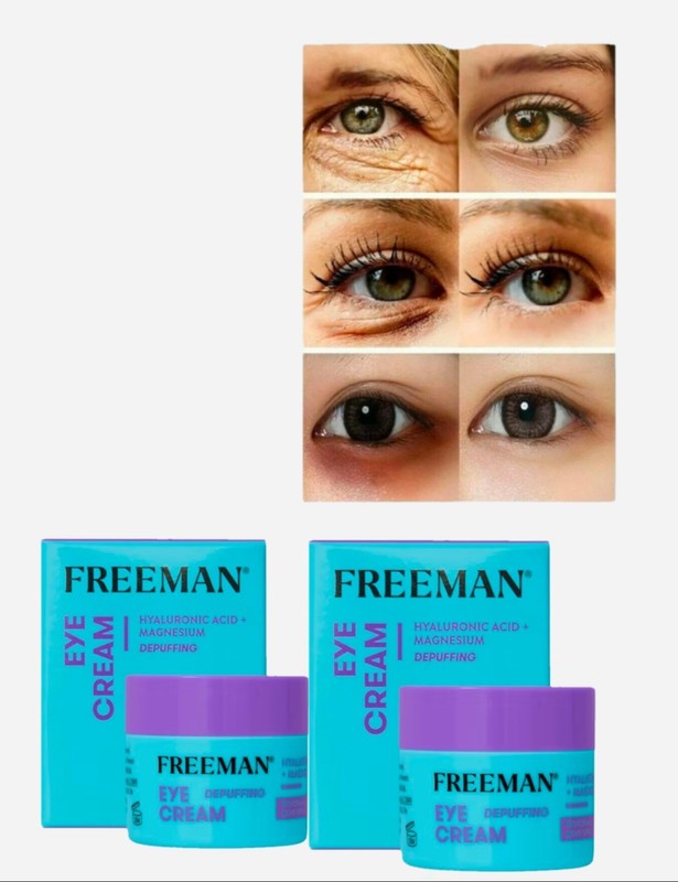 2 Crema Para Las Ojeras Anti-arrugas Remueve Bolsas En Los Ojos Circulos Oscuros
