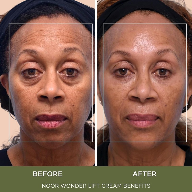 Noor Wonder Lift Cream – Dermatologist-Approved Wrinkle Reduction for All Ages gallery