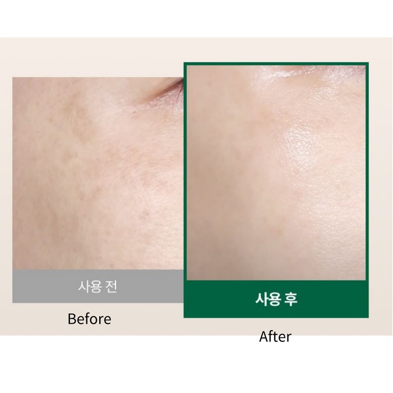 Easydew DW-EGF Melatoning Oneday Ampoule 30ml & Cream 50g Synergy Effect gallery