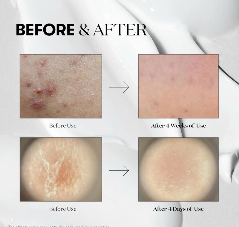 VT Cosmetics CICA REEDLE SHOT 700 Microneedling Spot Treatment Serum, 1oz / 30ml gallery