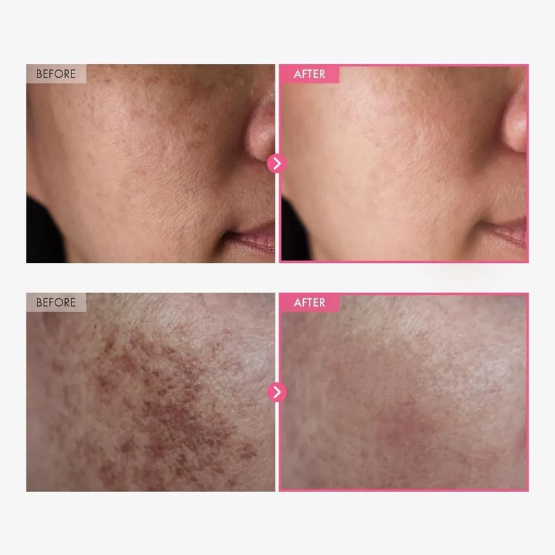 Arbutin 7% Tranexamic Acid 4% Cream 50ml Brightening K-Beauty Skin Care gallery
