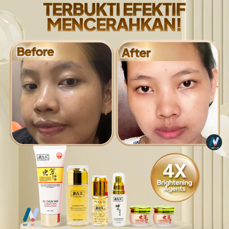 YU CHUN MEI SET 6 Anti-Aging Bright Collagen Castor Oil Ginseng Acne Moist Glow gallery
