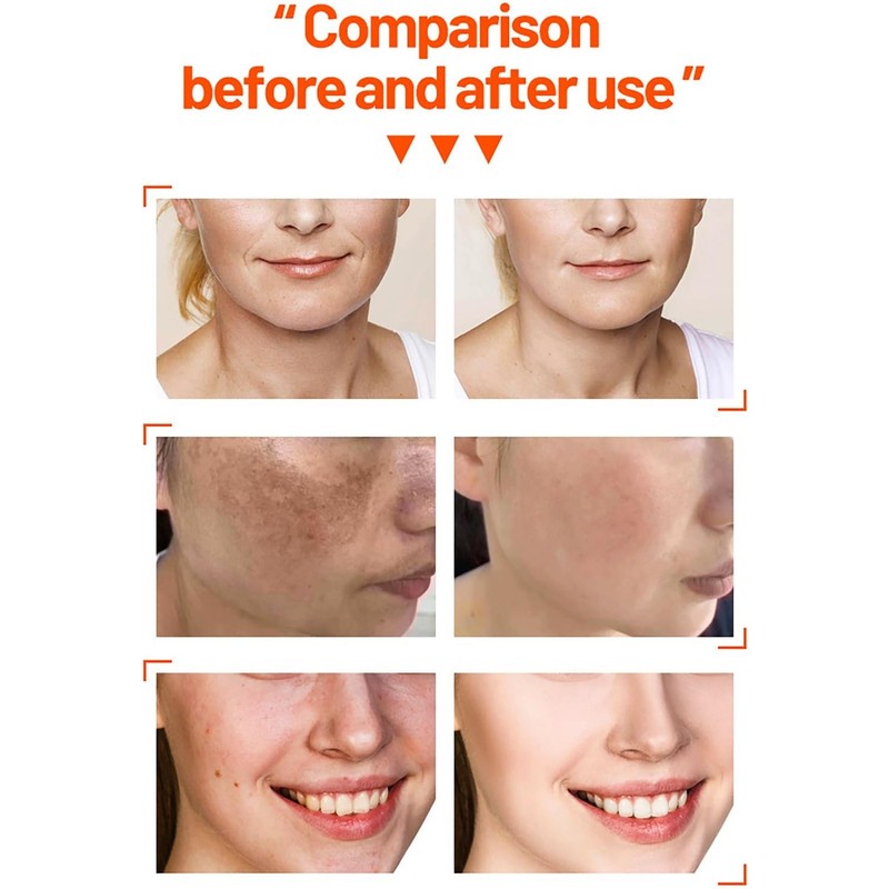 DISAAR BEAUTY Vitamin C Orange Extract Skin Care Set 30ml+30ml+10ml+15g 4PCS gallery