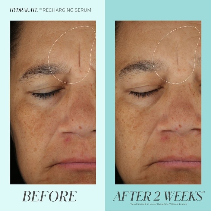 Kate Somerville HydraKate Recharging Serum with Hyaluronic Acid 2606979 gallery