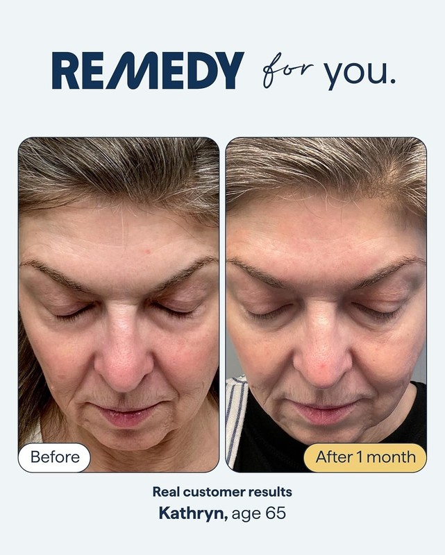 Dermatologist-Created Anti-Aging Serum - Youthful Skin for All Skin Types gallery