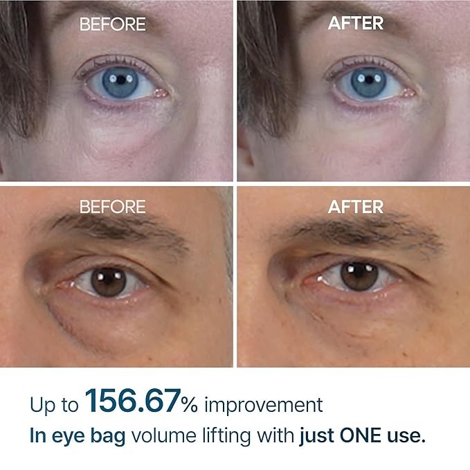 Dr.Melaxin Eyephalt Eyecream for Eyebags Puffiness Wrinkles 10ml Exp.Date 03/28 gallery